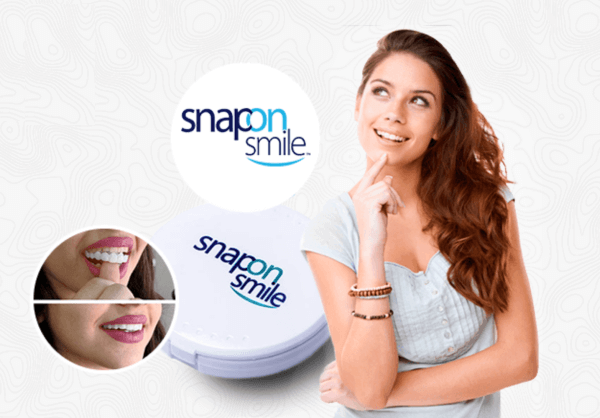 Snap-On Smile България - Мнения, цена, ефекти